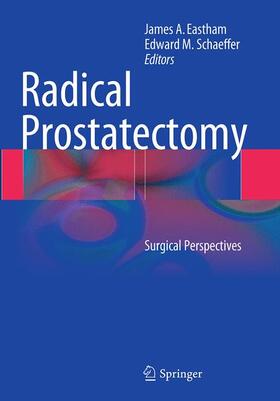 Schaeffer / Eastham |  Radical Prostatectomy | Buch |  Sack Fachmedien