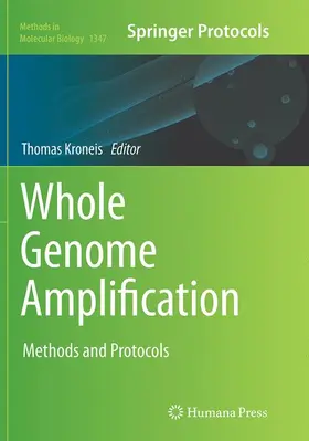 Kroneis |  Whole Genome Amplification | Buch |  Sack Fachmedien