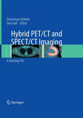 Israel / Delbeke |  Hybrid PET/CT and SPECT/CT Imaging | Buch |  Sack Fachmedien