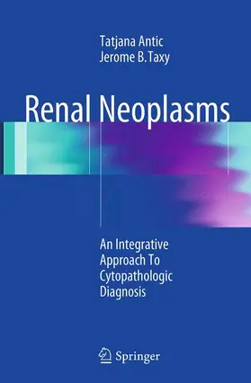 Antic / Taxy |  Renal Neoplasms | Buch |  Sack Fachmedien