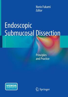 Fukami |  Endoscopic Submucosal Dissection | Buch |  Sack Fachmedien