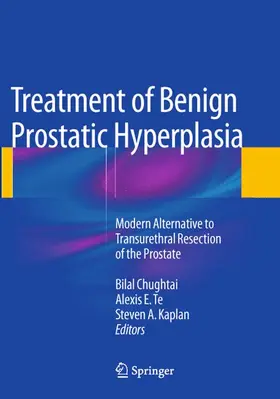 Chughtai / Kaplan / Te |  Treatment of Benign Prostatic Hyperplasia: Modern Alternative to Transurethral Resection of the Prostate | Buch |  Sack Fachmedien