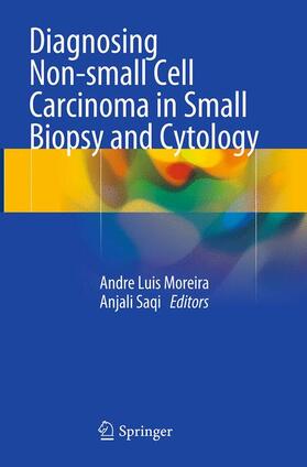 Saqi / Moreira |  Diagnosing Non-small Cell Carcinoma in Small Biopsy and Cytology | Buch |  Sack Fachmedien