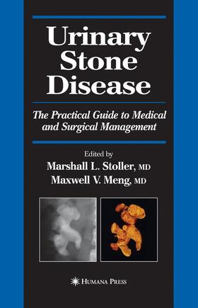 Meng / Stoller |  Urinary Stone Disease | Buch |  Sack Fachmedien