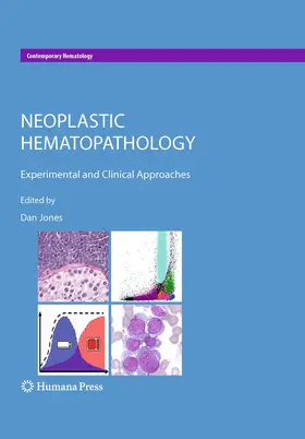 Jones |  Neoplastic Hematopathology | Buch |  Sack Fachmedien