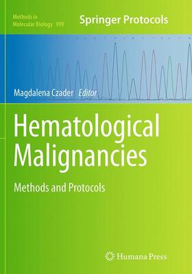 Czader |  Hematological Malignancies | Buch |  Sack Fachmedien