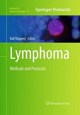 Küppers |  Lymphoma | Buch |  Sack Fachmedien