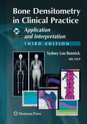 Bonnick |  Bone Densitometry in Clinical Practice | Buch |  Sack Fachmedien