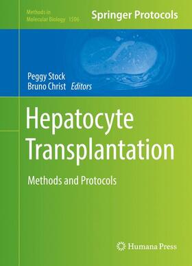 Christ / Stock |  Hepatocyte Transplantation | Buch |  Sack Fachmedien