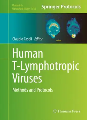 Casoli |  Human T-Lymphotropic Viruses | Buch |  Sack Fachmedien