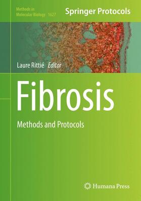 Rittié |  Fibrosis | Buch |  Sack Fachmedien