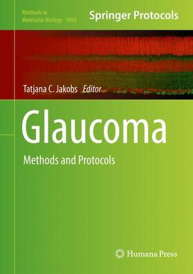 Jakobs |  Glaucoma | Buch |  Sack Fachmedien