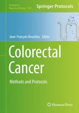 Beaulieu |  Colorectal Cancer | Buch |  Sack Fachmedien