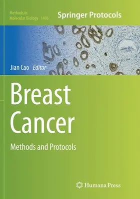 Cao |  Breast Cancer | Buch |  Sack Fachmedien