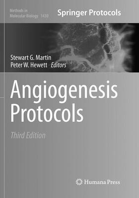 Hewett / Martin |  Angiogenesis Protocols | Buch |  Sack Fachmedien