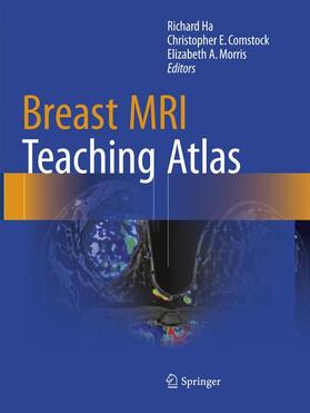 Ha / Morris / Comstock |  Breast MRI Teaching Atlas | Buch |  Sack Fachmedien