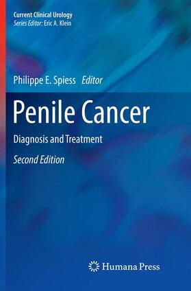 Spiess |  Penile Cancer | Buch |  Sack Fachmedien