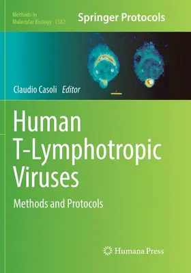 Casoli |  Human T-Lymphotropic Viruses | Buch |  Sack Fachmedien