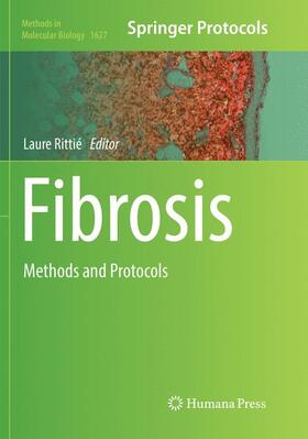 Rittié |  Fibrosis | Buch |  Sack Fachmedien