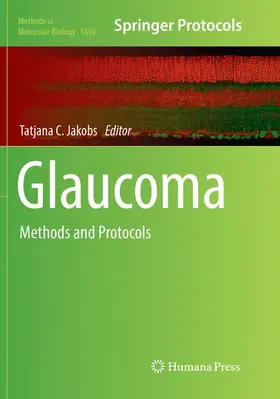 Jakobs |  Glaucoma | Buch |  Sack Fachmedien