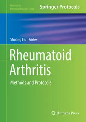 Liu | Rheumatoid Arthritis | E-Book | sack.de