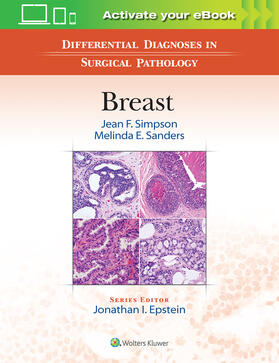 Simpson / Sanders |  Differential Diagnoses in Surgical Pathology: Breast | Buch |  Sack Fachmedien