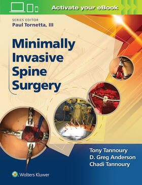 Tannoury |  Minimally Invasive Spine Surgery | Buch |  Sack Fachmedien