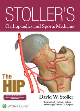 Stoller |  Stoller's Orthopaedics and Sports Medicine: The Hip | Buch |  Sack Fachmedien