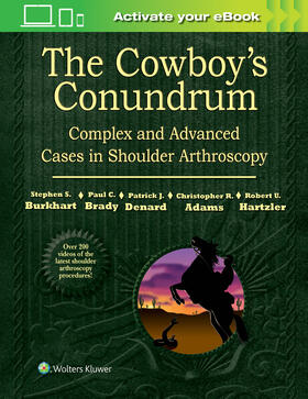 Burkhart |  The Cowboy's Conundrum: Complex and Advanced Cases in Shoulder Arthroscopy | Buch |  Sack Fachmedien