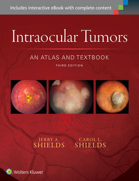 Shields |  Intraocular Tumors: An Atlas and Textbook | Buch |  Sack Fachmedien