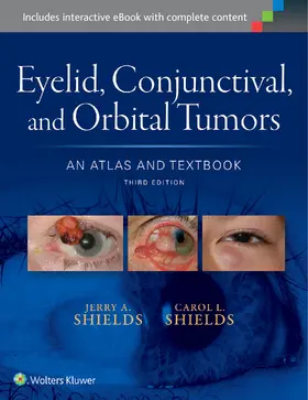 Shields | Eyelid, Conjunctival, and Orbital Tumors: An Atlas and Textbook | Buch | 978-1-4963-2148-0 | sack.de