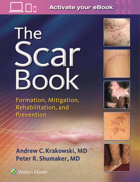 Krakowski / Shumaker |  The Scar Book | Buch |  Sack Fachmedien