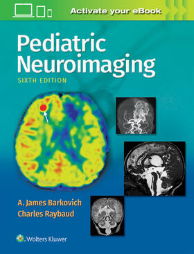 Barkovich / Raybaud |  Pediatric Neuroimaging | Buch |  Sack Fachmedien