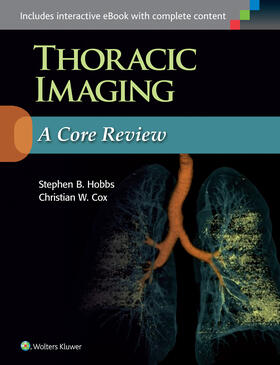 Hobbs / Cox |  Thoracic Imaging: A Core Review | Buch |  Sack Fachmedien
