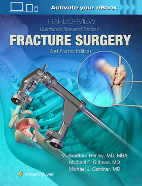 Henley |  Harborview Illustrated Tips and Tricks in Fracture Surgery | Buch |  Sack Fachmedien