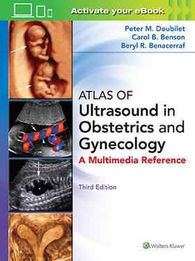 Doubilet / Benson / Benacerraf |  Atlas of Ultrasound in Obstetrics and Gynecology | Buch |  Sack Fachmedien