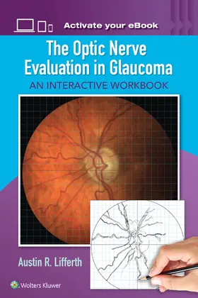 Lifferth |  Optic Nerve Evaluation in Glaucoma | Buch |  Sack Fachmedien