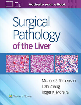 Torbenson / Moreira / Zhang |  Surgical Pathology of the Liver | Buch |  Sack Fachmedien