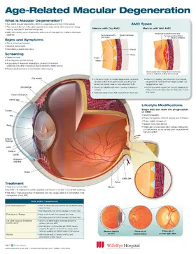  Age-Related Macular Degeneration | Sonstiges |  Sack Fachmedien