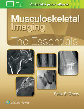 Chew |  Musculoskeletal Imaging: The Essentials | Buch |  Sack Fachmedien