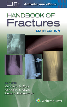 Egol |  Handbook of Fractures | Buch |  Sack Fachmedien