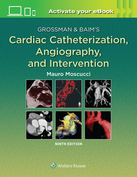 Moscucci |  Grossman & Baim's Cardiac Catheterization, Angiography, and Intervention | Buch |  Sack Fachmedien