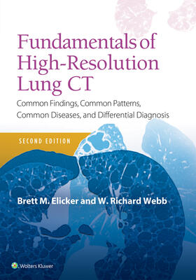 Elicker / Webb |  Fundamentals of High-Resolution Lung CT | Buch |  Sack Fachmedien