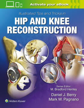 Berry / Pagnano |  Illustrated Tips and Tricks in Hip and Knee Reconstructive and Replacement Surgery | Buch |  Sack Fachmedien