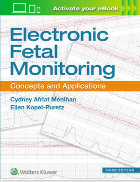 Menihan |  Electronic Fetal Monitoring | Buch |  Sack Fachmedien
