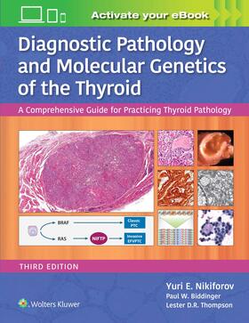 Nikiforov / Biddinger / Thompson |  Diagnostic Pathology and Molecular Genetics of the Thyroid | Buch |  Sack Fachmedien