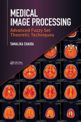 Chaira |  Medical Image Processing | Buch |  Sack Fachmedien
