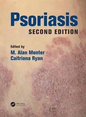 Menter / Ryan |  Psoriasis | Buch |  Sack Fachmedien