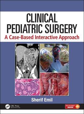 Emil |  Clinical Pediatric Surgery | Buch |  Sack Fachmedien