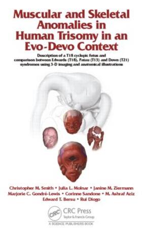 Diogo / Smith / Ziermann |  Muscular and Skeletal Anomalies in Human Trisomy in an Evo-Devo Context | Buch |  Sack Fachmedien